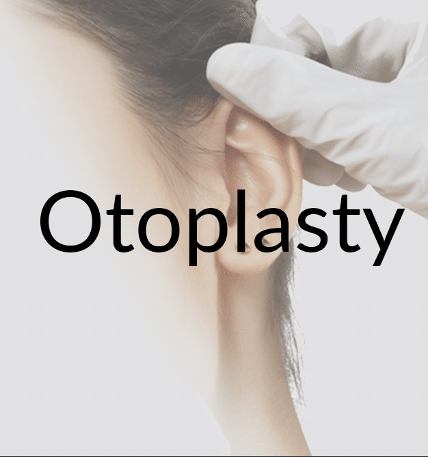 otoplasty